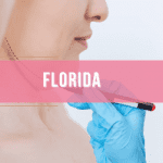 Bichectomia - Florida